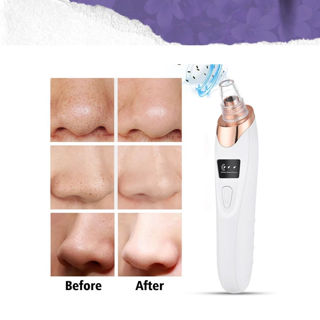 Ultrasonic Electric Facial Pore Deep Cleaning Acne Remover