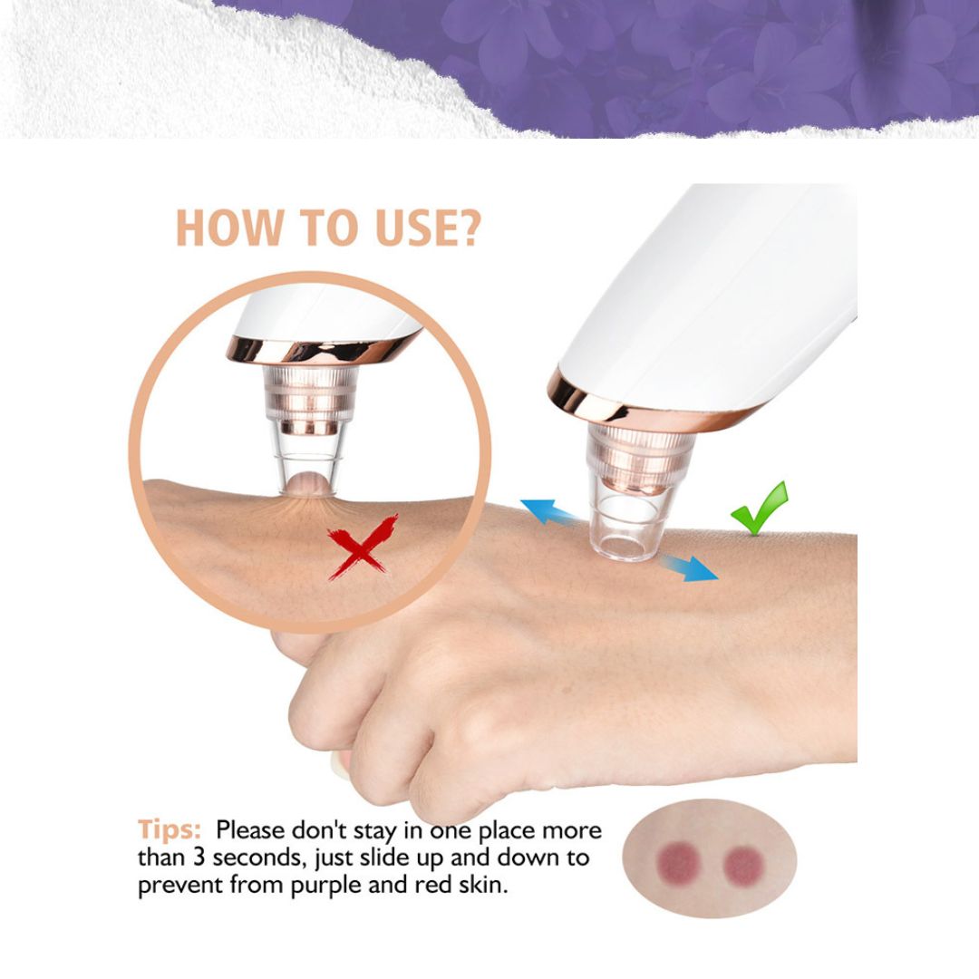 Ultrasonic Electric Facial Pore Deep Cleaning Acne Remover